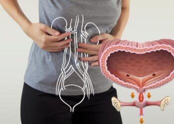 Incontinencia urinaria: un problema más común de lo que parece