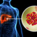 Hepatitis: qué es, cómo se transmite y cómo se trata